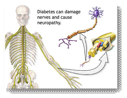 Nerve Diseases