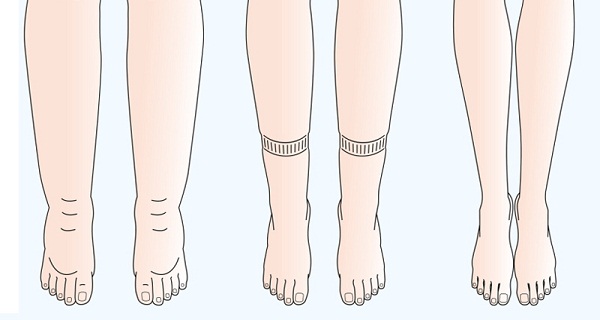 ¿TIENE LIBRAS DE AGUA RETENIDA EN SU CUERPO: AQUÍ HAY 6 MANERAS PROBADAS PARA ELIMINAR LA HINCHAZÓN ¿TIENE LIBRAS DE AGUA RETENIDA EN SU CUERPO: AQUÍ HAY 6 MANERAS PROBADAS PARA ELIMINAR LA HINCHAZÓN