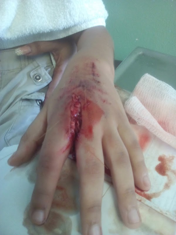 Que no quede fea doctor!!! Herida en mano Que no quede fea doctor!!! Herida en mano