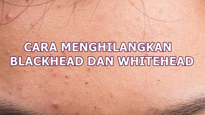 blackhead dan whitehead
