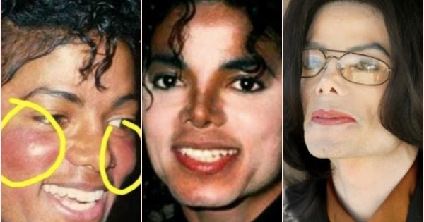 The Reason Behind The Transformation Of Michael Jackson S Physical
