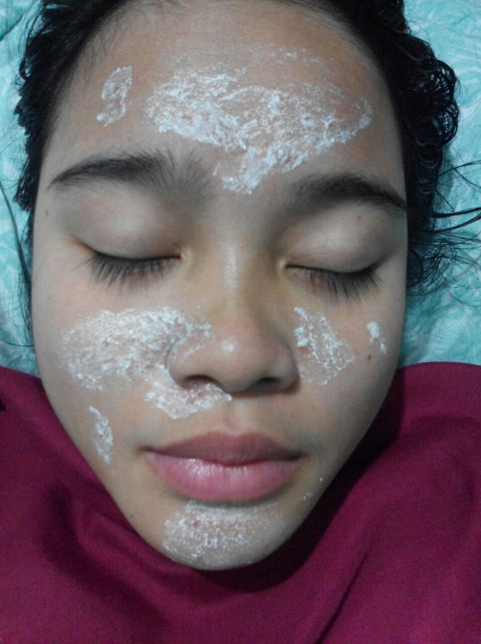 AJAG IJIG CURHATAN TENTANG JERAWAT DAN DOKTER INONG IRANA