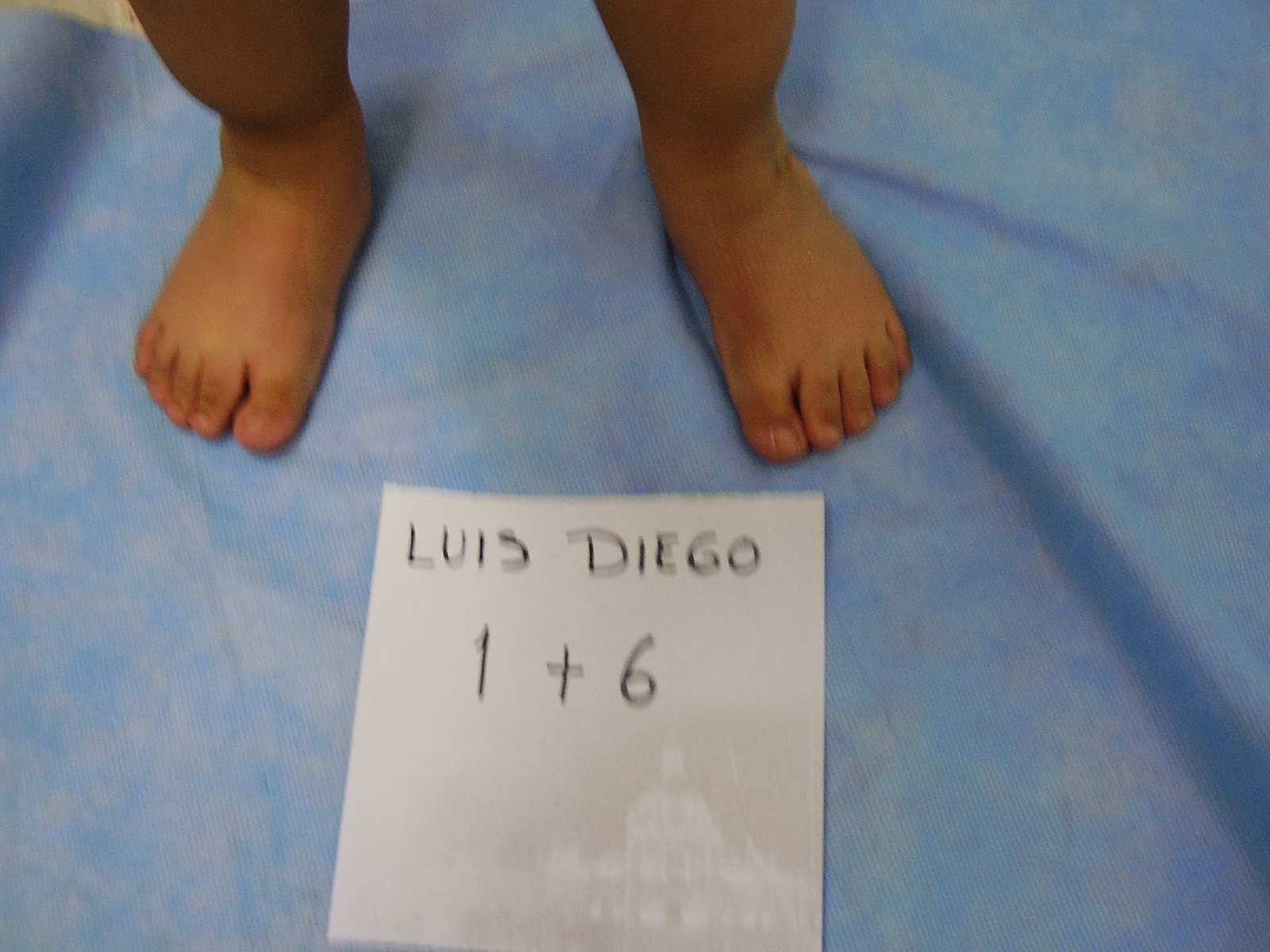 ortopediatrica PIE EQUINO VARO CONGÉNITO