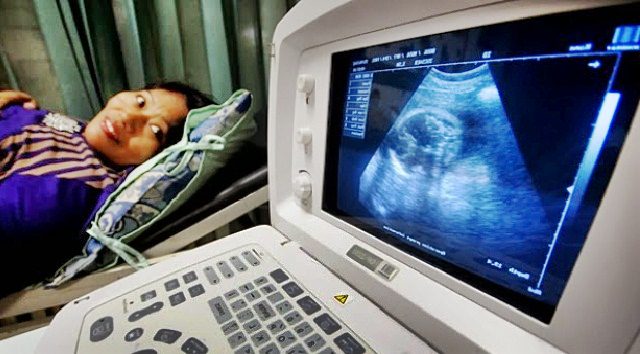 inilah 12 Alasan Penting Periksa USG Untuk Ibu Hamil inilah 12 Alasan Penting Periksa USG Untuk Ibu Hamil
