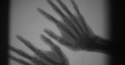 Radiografi Digital Adalah - masyog.com