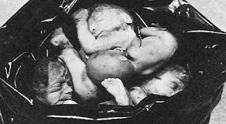 Bayi-bayi cacat hasil kelahiran orang yang terjangkit parasit T.Gondii