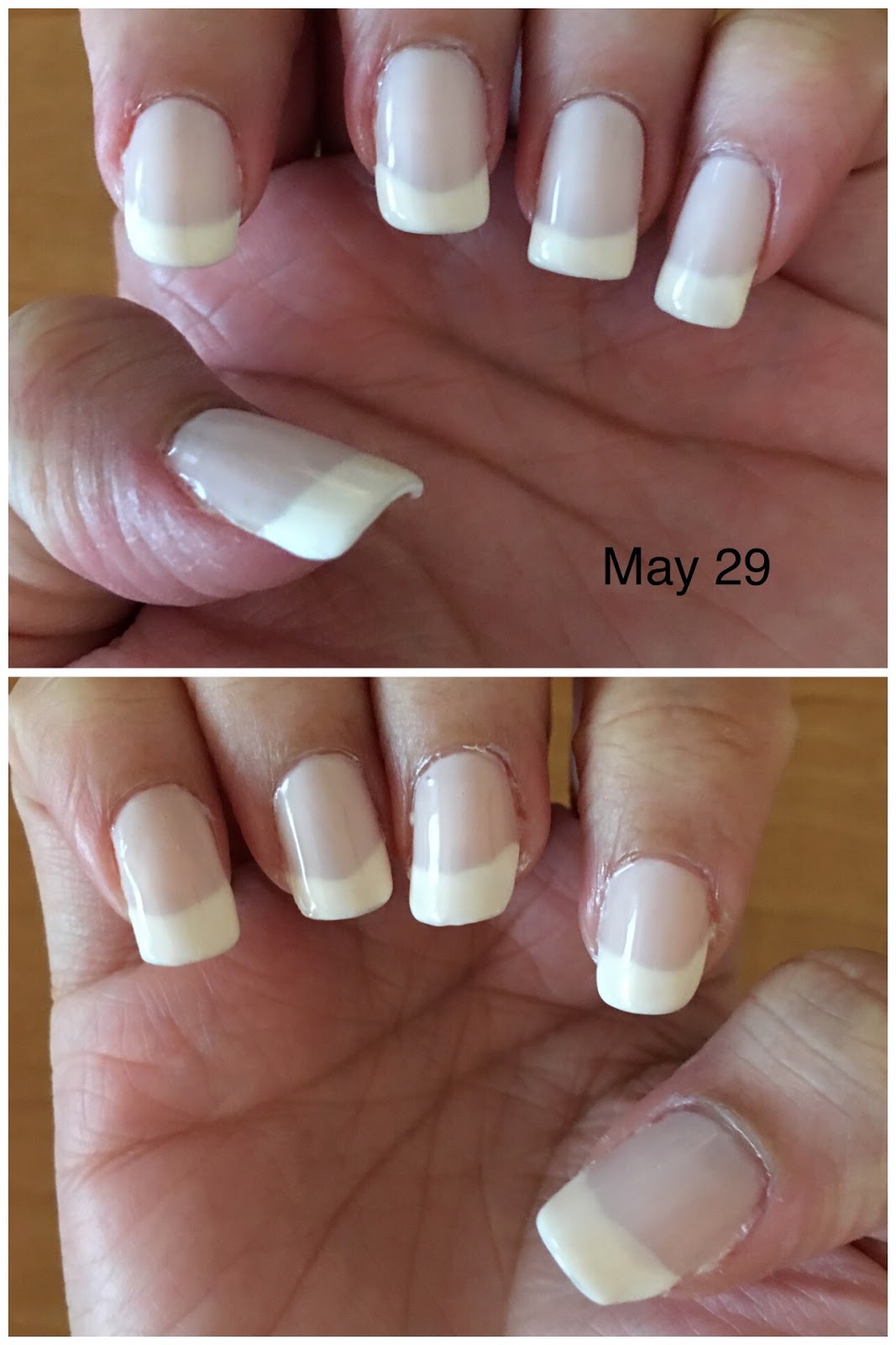How to Save and Regrow Nails After a Break
