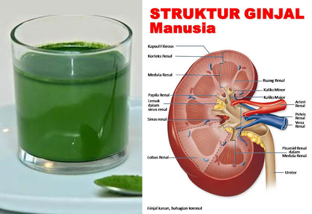 Cara Baru, Cuci Ginjal dengan Biaya Kurang dari 10 Ribu Saja