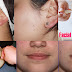 Face packs/masks to Reduce Facial Hair
