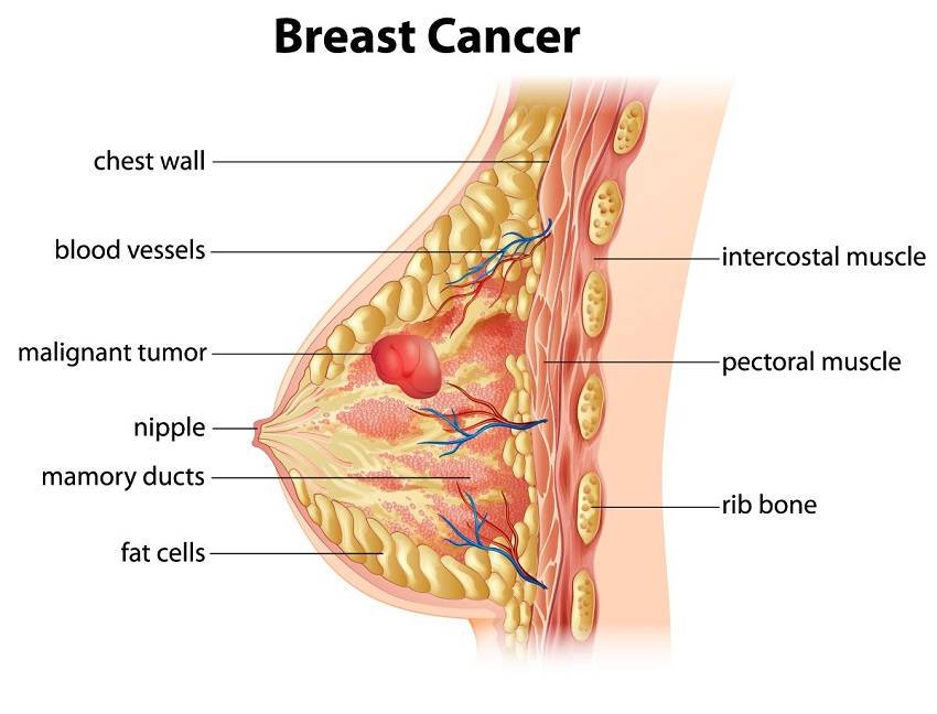 Women in China Rarely Get Breast Cancer and Here Is Why