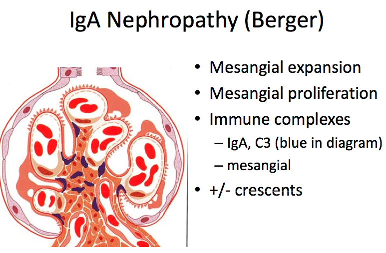 Renal disease Psychological Cares For IgA Nephropathy Patients renal-disease-psychological-cares-for-iga-nephropathy-patients
