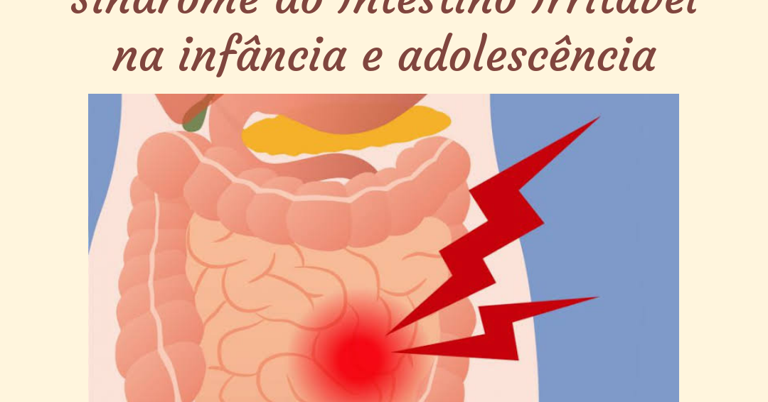 Dra. Daniela Mendonça Gastropediatra SÍNDROME DO INTESTINO IRRITÁVEL Dra. Daniela Mendonça Gastropediatra SÍNDROME DO INTESTINO IRRITÁVEL