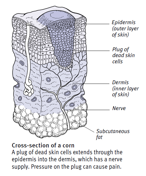 corn ~ Nursing