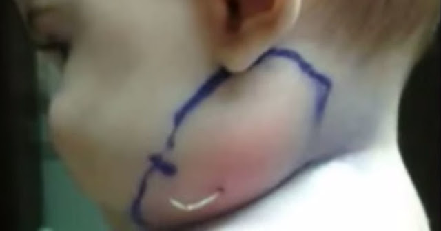 Dokter Terkejut Melihat Muka Bayi 7 Bulan ini, Anda Pasti Kasihan Melihatnya Dokter Terkejut Melihat Muka Bayi 7 Bulan ini, Anda Pasti Kasihan Melihatnya