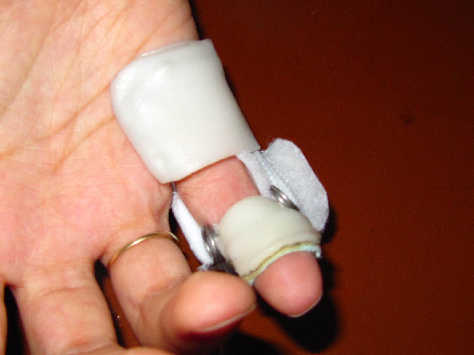 Orthèses Lyon Traumatologie