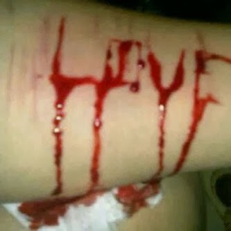 welcome!: 'Emo' budaya salah silet silet tangan.