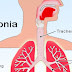 Pengertian Lengkap Tentang Penyakit Paru Paru Pneumonia