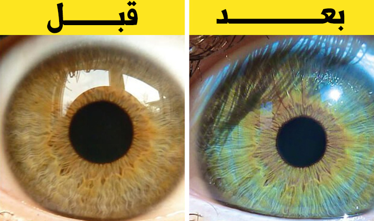 5 أشياء تمكنكم من تغيير لون أعينكم