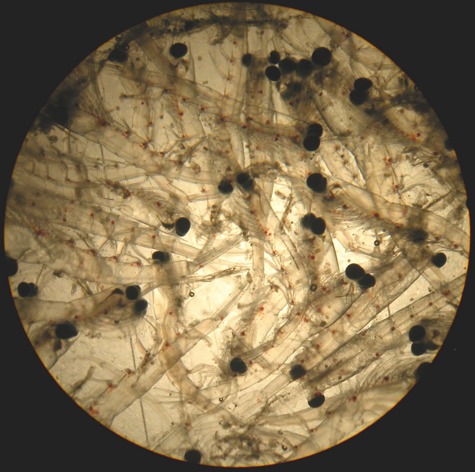 Microscope Bacteria Under Fingernails Pictures Micropedia