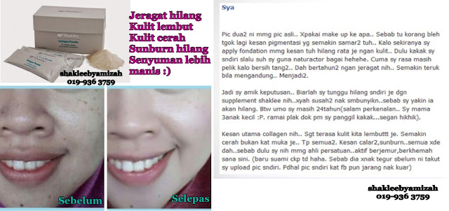 cara hilangkan jeragat cepat tanpa rawatan laser cara hilangkan jeragat cepat tanpa rawatan laser