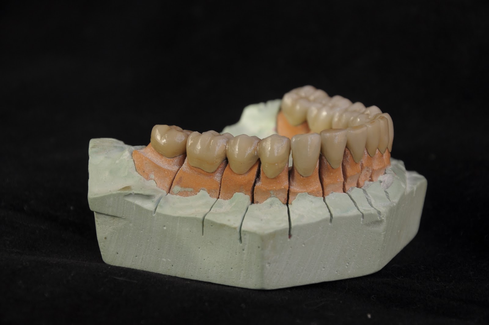 Bruciatore A Sfera Composito Dentale Set Di 5 Strumenti Restaurativi - Foto 4