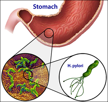 Dissertation h helicobacter infection pylori