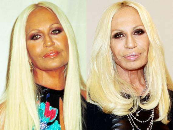 Botox, waist-length hair extensions and years of sun-worshipping - the  changing look of Donatella Versace