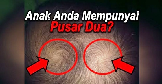 Mau Tau Anak Anda Memiliki Pusar Dua? Ramai Yang Tidak Tahu Rahsia Anak Yang Memiliki Dua Pusar Di Kepala.. Mau Tau Anak Anda Memiliki Pusar Dua? Ramai Yang Tidak Tahu Rahsia Anak Yang Memiliki Dua Pusar Di Kepala..