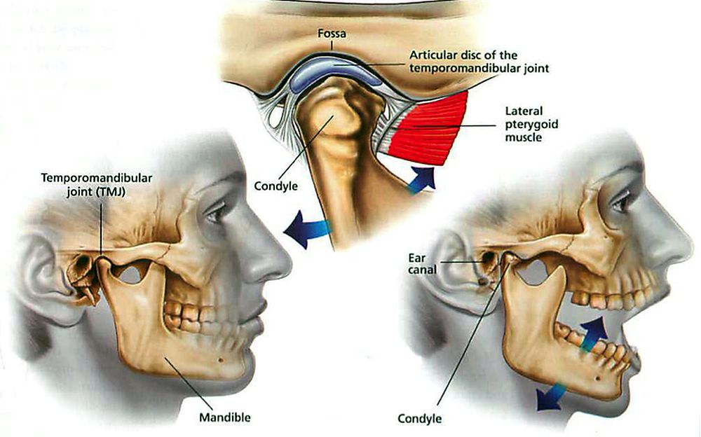 TMJ-Jaw Pain