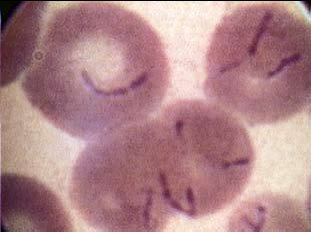 Bartonella bacilliformis dengan pengecatan Giemsa (5000x) Bartonella bacilliformis dengan pengecatan Giemsa (5000x)