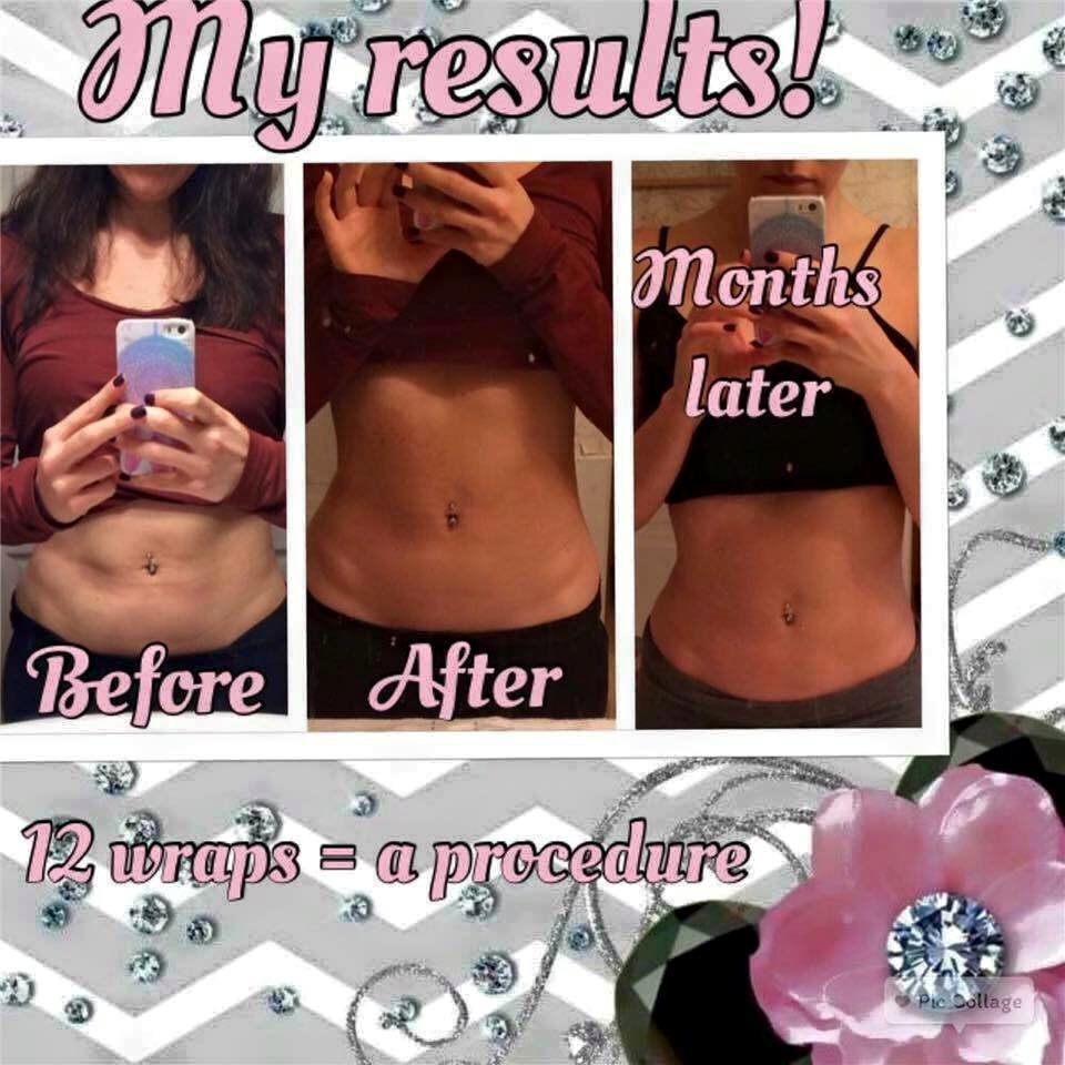 It Works! Ultimate Body Applicator Wraps Before & After Pictures