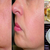 How To Get Rid Wrinkles And Sagging Facial Skin Using Coconut Oil and Essential Oil