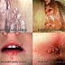 Obat Kutil Kelamin Jamu Ampuh Natural thumbnail