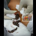 Gempar!!! Doktor sangka ada ketumbuhan, lihat apa yang keluar dari kaki lelaki ini amat mengejutkan!
