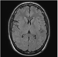 head scan MRI