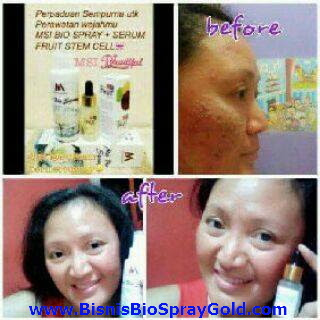 Testimoni MSI Bio Spray - Multy Spray Testimoni MSI Bio Spray, Testimoni MSI Multy Spray