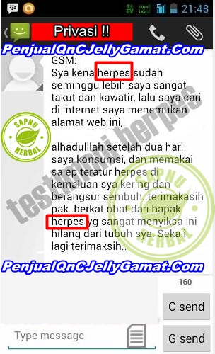 Cara Mengobati Kurap Di Selangkangan Secara Alami Sampai Tuntas Cara Mengobati Kurap Di Selangkangan Secara Alami Sampai Tuntas