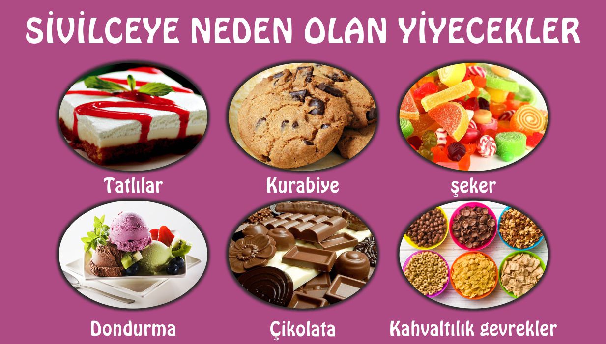 Akneye Neden Olan Gıda Türleri Akneye Neden Olan Gıda Türleri