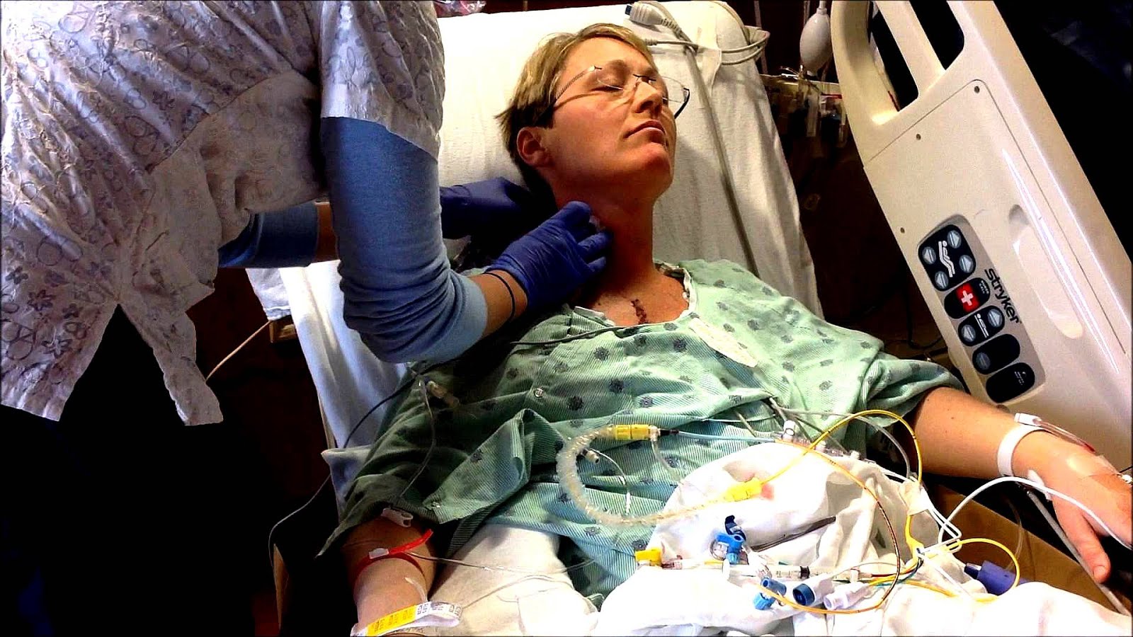 Care After Bypass Surgery Of Heart Hear Choices