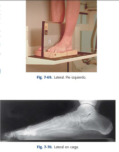 rx rodilla lateral en carga