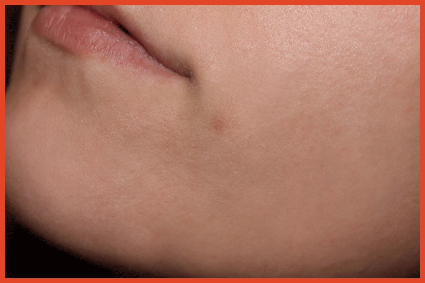 comment appliquer cicalfate