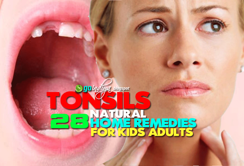 Home Remedies For Tonsillitis In Adults Home Remedies For Tonsillitis In Adults