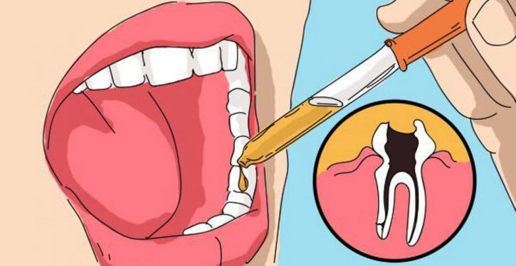  Causes of dental pain