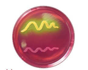 Contoh warna koloni bakteri yang tumbuh pada media MSA