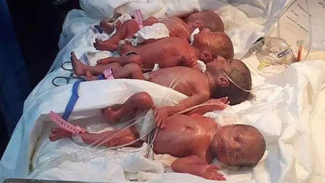 Seorang Ibu Lahirkan Bayi Kembar 7, Petama Kali Dalam Sejarah Irak