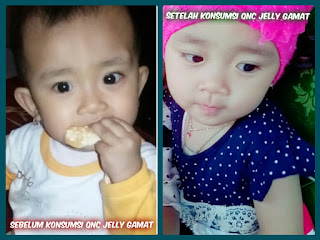 Obat Benjolan di Pergelangan Tangan ini SANGAT MUJARAB Mengobati Benjolan di Pergelangan Tangan ~ TESTIMONI QNC JELLY GAMAT Obat Benjolan di Pergelangan Tangan ini SANGAT MUJARAB Mengobati Benjolan di Pergelangan Tangan ~ TESTIMONI QNC JELLY GAMAT