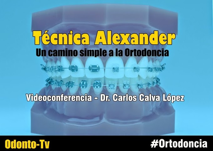 TÉCNICA ALEXANDER: Un camino simple a la Ortodoncia - Videoconferencia del Dr. Carlos Calva