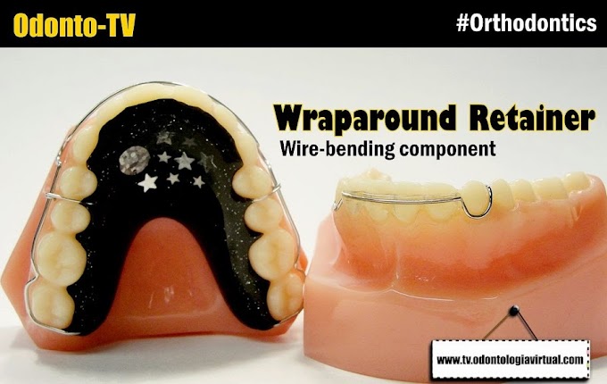 WRAPAROUND RETAINER: Wire-bending component