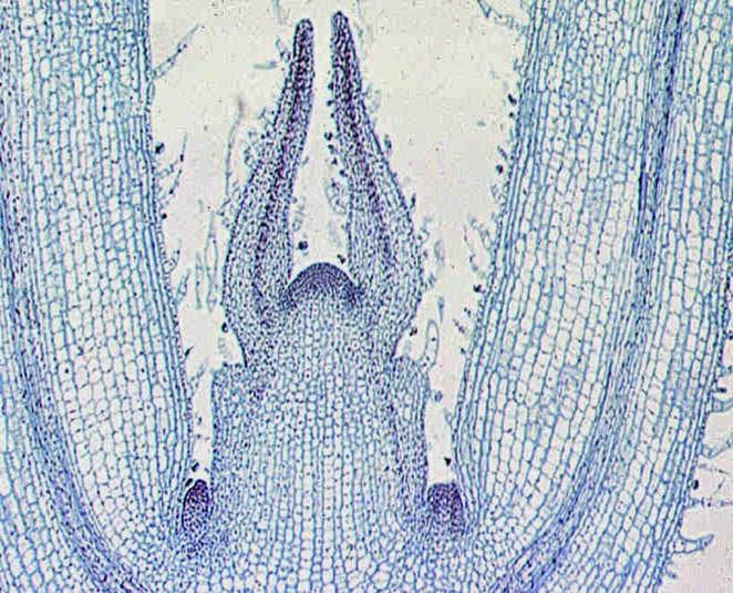 Какой микропрепарат изображен на рисунке. Меристема ткани растений. Апикальная меристема корня микроскоп. Меристема побега. Конус нарастания побега элодеи.