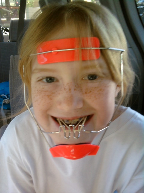 Приложение примерка зубов. Маска диляра. Маска брекеты примерить. Брекеты с лицевой дугой headgear. Красивые девушки с брекетами.